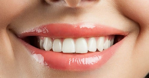Niềng răng trả góp Cần Thơ - Hình thức đăng ký 1 Niềng răng trả góp Cần Thơ - Hình thức đăng ký 1