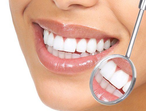 Răng hô nhẹ - Giải pháp khắc phục hiệu quả 2
