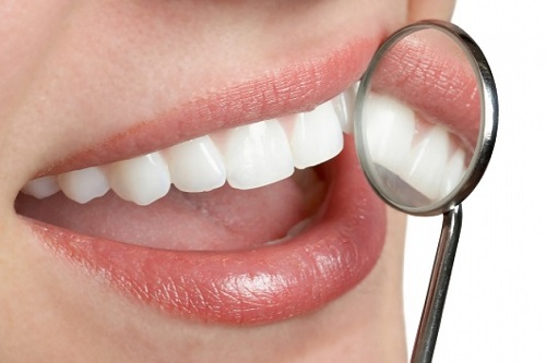 Giải đáp thắc mắc - Trồng răng giả có niềng được không? 2