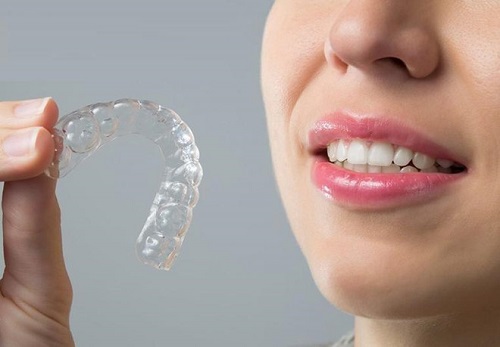Niềng răng trong suốt có hiệu quả không? Nha khoa tư vấn 2 Niềng răng trong suốt có hiệu quả không? Nha khoa tư vấn 2