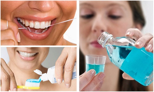 Răng khôn mọc kẹt - Phương pháp xử lý dứt điểm 3