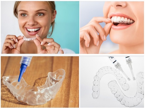 Sản phẩm làm trắng răng an toàn - Nhờ nha khoa tư vấn 2