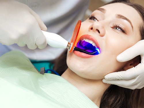 Sản phẩm làm trắng răng an toàn - Nhờ nha khoa tư vấn 3