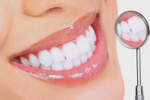 Tẩy trắng răng xong có được đánh răng không? 1