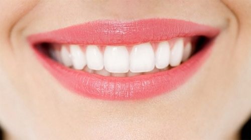 Dụng cụ niềng răng tại nhà 3 giai đoạn - Thông tin cần biết 1