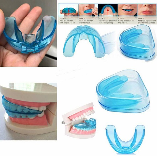 Dụng cụ niềng răng tại nhà 3 giai đoạn - Thông tin cần biết 2