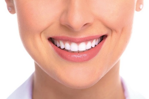Niềng răng xong có nên tẩy trắng răng? Thông tin nha khoa 1 Niềng răng xong có nên tẩy trắng răng? Thông tin nha khoa 1