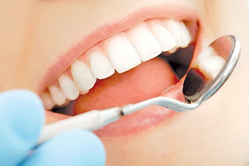 Răng sứ có mài được không? Chuyên gia giải đáp 2 Răng sứ có mài được không? Chuyên gia giải đáp 2