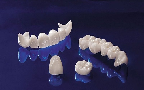 Răng sứ bị vàng nguyên nhân do đâu? 2 Răng sứ bị vàng nguyên nhân do đâu? 2