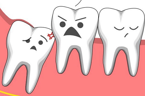 Bác sĩ nhổ răng khôn giỏi an toàn hiện nay 2